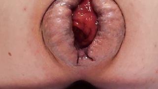 Contender For Largest Ass Inside-Out (Masculine Warning!)