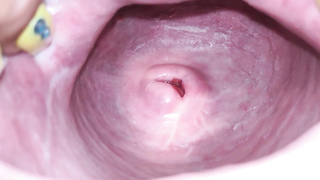 Cervix close up [4k]