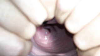 Cervix close up [4k]