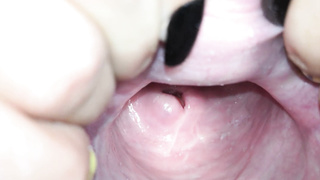 Cervix close up [4k]