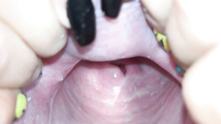 Cervix close up [4k]