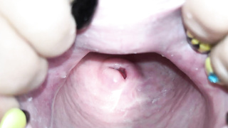 Cervix close up [4k]