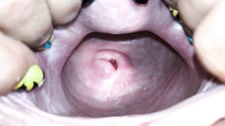 Cervix close up [4k]