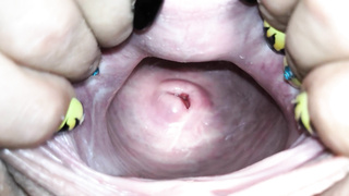 Cervix close up [4k]