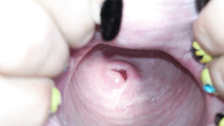 Cervix close up [4k]