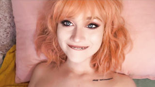 Wondrous Ache- Red-Haired Braceface