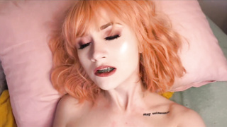 Wondrous Ache- Red-Haired Braceface