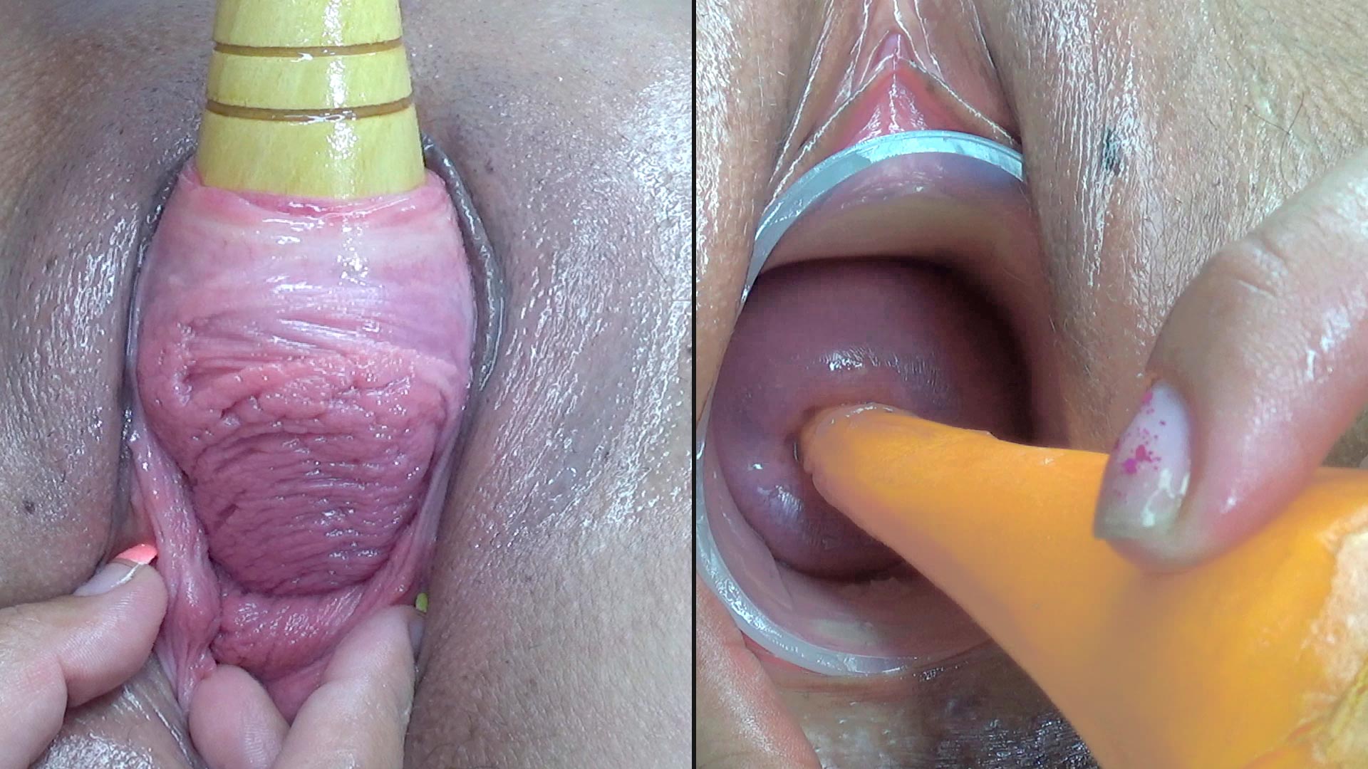 Lesbians Pee Hole Penetration and Cervix Fucking image photo