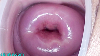 Cervix Stretching and Uterus Dilation with Penetration