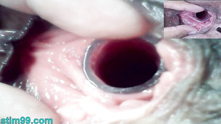 Lesbians Extreme Cervix Play and Peehole Fucking Penis Dildo