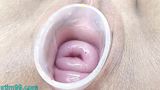 Japanese Wife Open Cervix Wide to watch inside Uterus