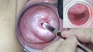 Japanese Endoscope Cam inside Cervix and Pussy