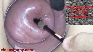 Japanese Endoscope Cam inside Cervix and Pussy