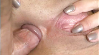 R-47