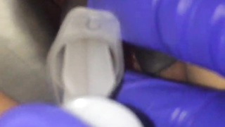 Cervix extraordinary obgyn have fun