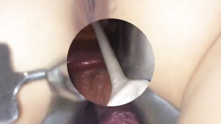 Cervix extraordinary obgyn have fun