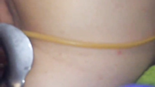 Cervix extraordinary obgyn have fun