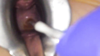 Cervix extraordinary obgyn have fun