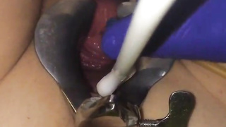 Cervix extraordinary obgyn have fun